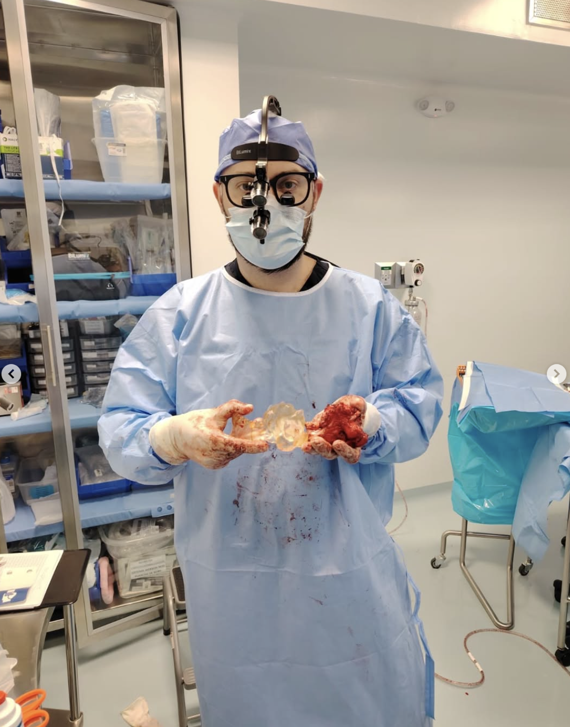 This 25 year old Guatemalan had a skull base tumor.